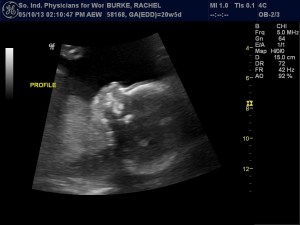 58168_RACHEL BURKE_20130510142501_45